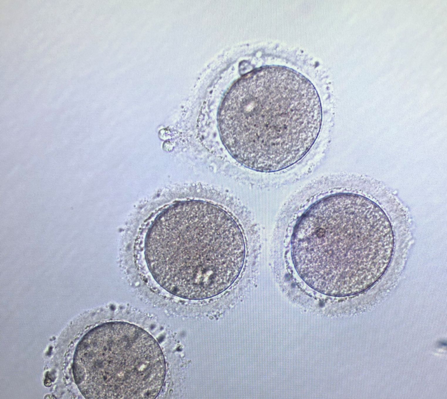 FAeggs